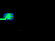 normal qrs interval